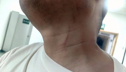 武汉男子拍摄违停时被当街殴打,打人者被罚款500元,被打者称将提起行政复议并起诉