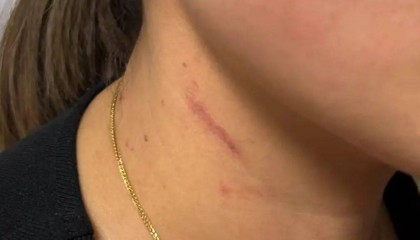 云南一男子酒后逼问妻子“是否出轨”并施暴,被警方行拘4日