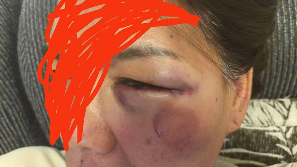 郑州女子摔伤后向饿了么平台索赔 矛盾规定让伤者陷入“理赔困局”